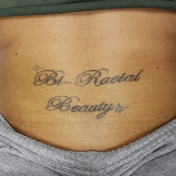 Laser Tattoo Removal Before and After | Comprehensive Laser & Aesthetics